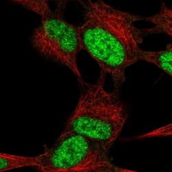 ROBO2 Antibody, Novus Biologicals 0.1mL; Unlabeled:Antibodies, Polyclonal